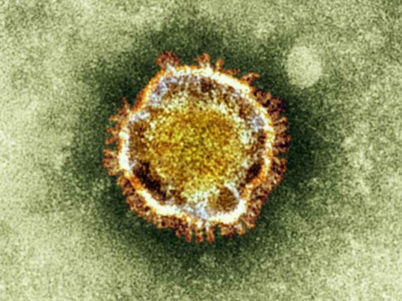 Una imagen de archivo de un coronavirus en el microscopio electrónico.