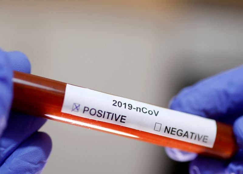 Gobernador de California declara emergencia por Covid-19