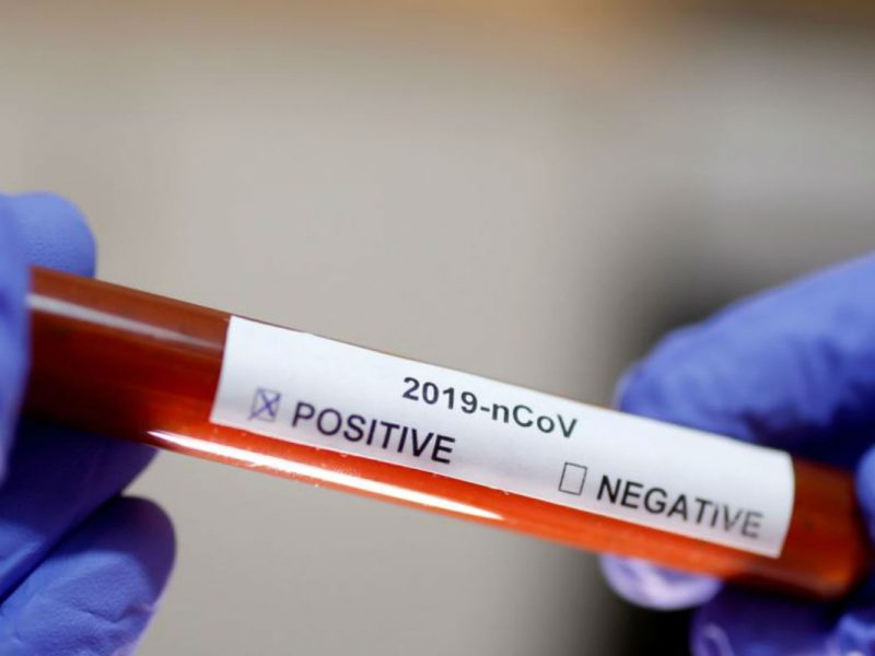 Prueba médica positiva Reuters VOA