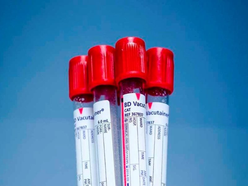 muestras de sangre