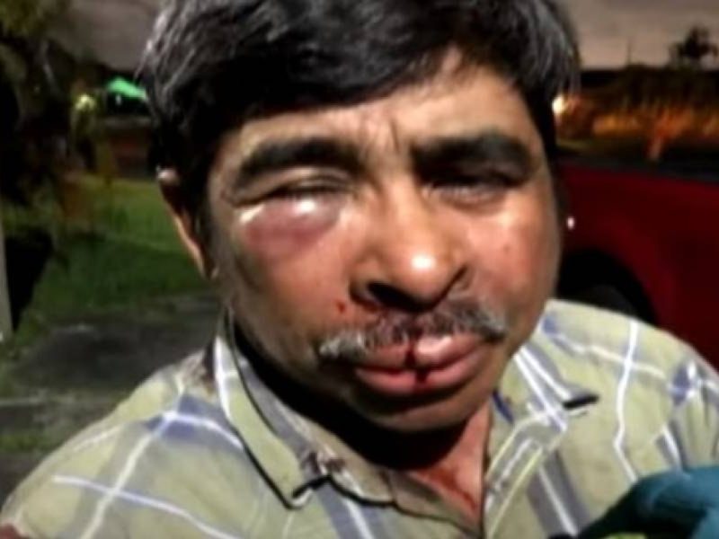 En Miami, golpean brutalmente a mexicano mientras paseaba a su perro