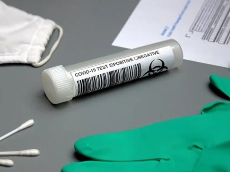 CDC consideran innecesario hacer pruebas de Covid-19 en asintomáticos