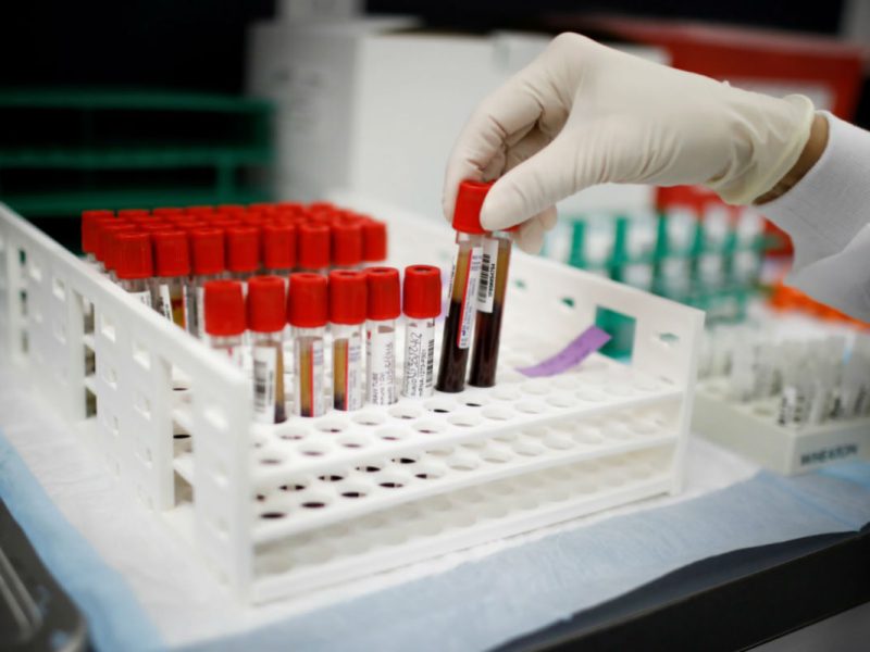 Vacuna Covid 19 Reuters Voz de América