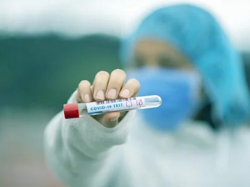 Citas para el test de Covid-19 en Los Ángeles ya no serán necesarias