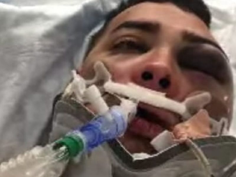 Kevin Chacón, migrante hondureño supuestamente golpeado por un agente de la Patrulla Fronteriza en Texas.