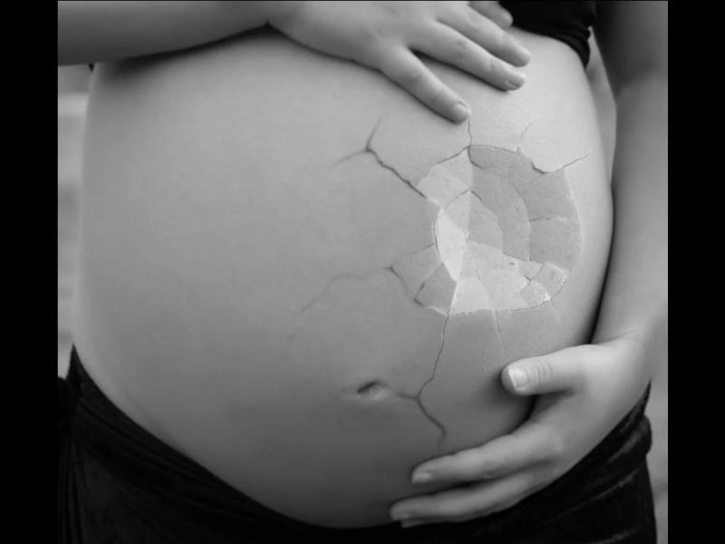 Discriminación por embarazo, conoce tus derechos como trabajadora indocumentada