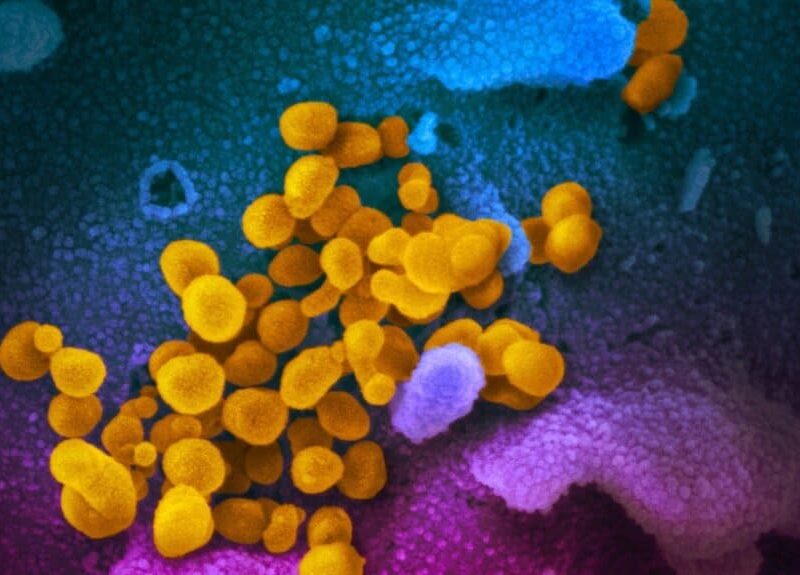 El virus del Covid-19 a través de un microscopio.