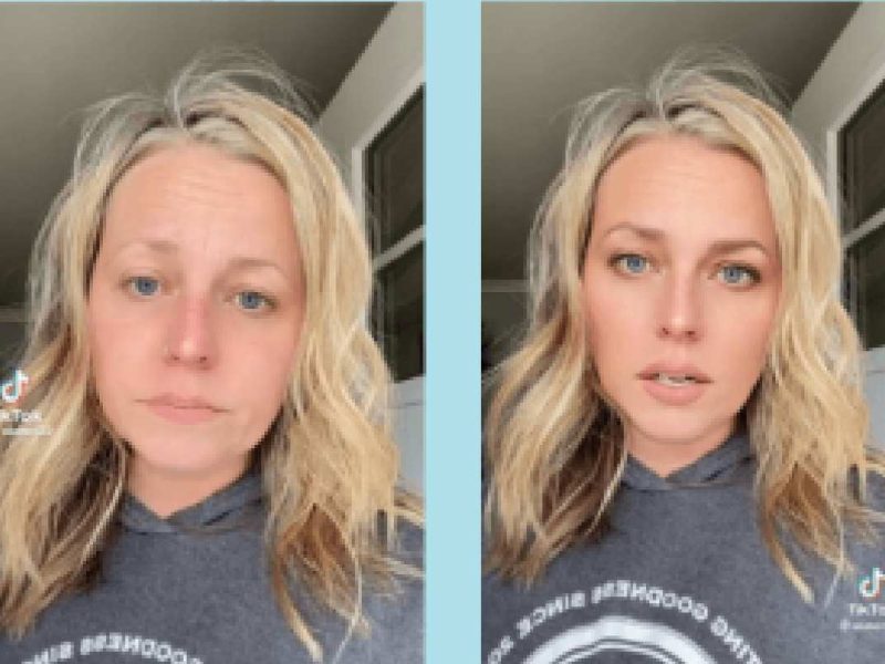 El uso de filtros en las fotos está influyendo a que las personas recurran a cirugías estéticas