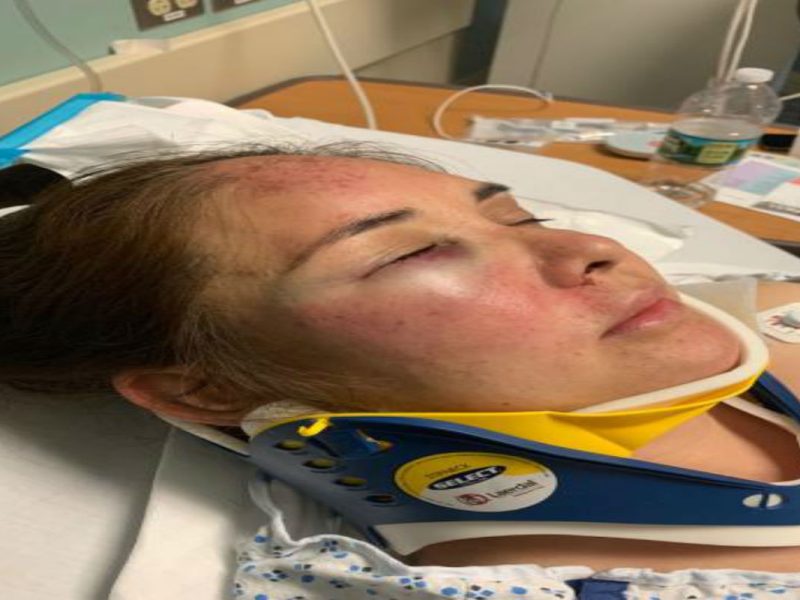 Migrante fue atacada por niño de 13 años tras defender a su hijo de burlas antiinmigrantes