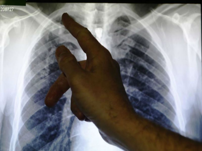 CBP se niega a revelar cuántos migrantes detenidos tienen enfermedades contagiosas