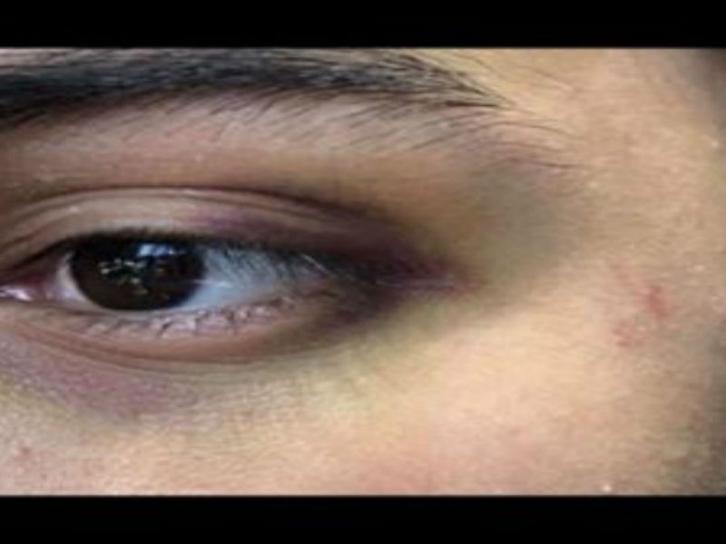 Joven de 16 años fue atacado por 3 adolescentes afroamericanos en un tren de Chicago