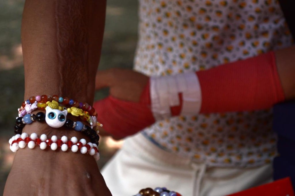 Franklin migrante que necesita una cirugía 