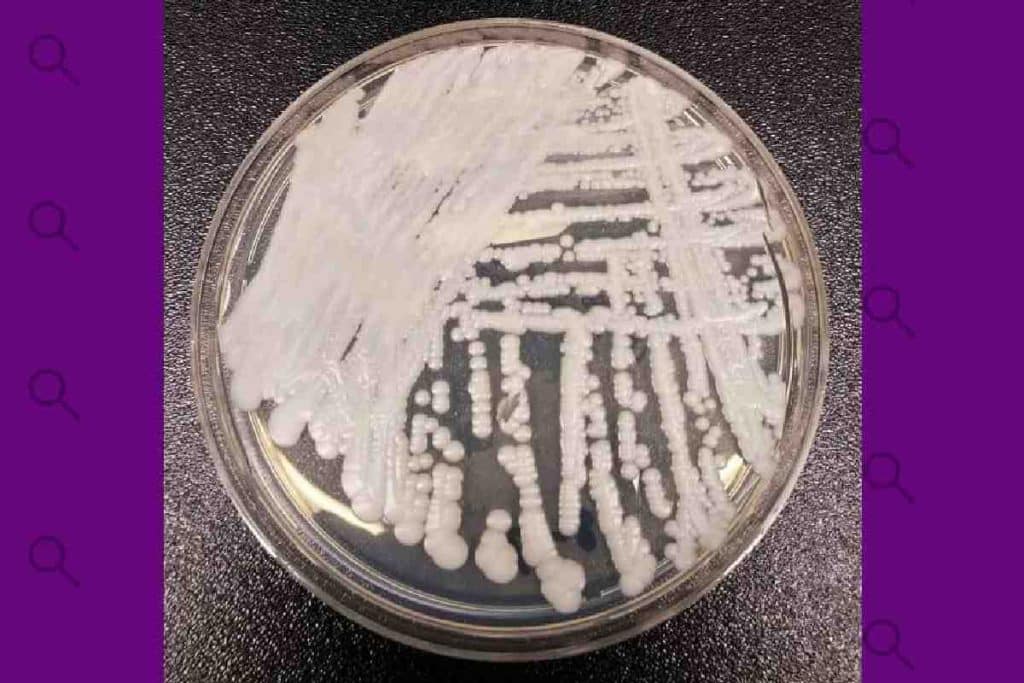 Con resistencia a los fármacos: el hongo ‘Candida auris’ que alerta a los especialistas en salud