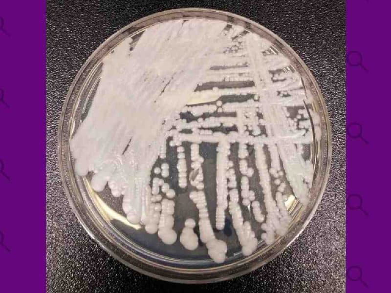 Con resistencia a los fármacos: el hongo ‘Candida auris’ que alerta a los especialistas en salud