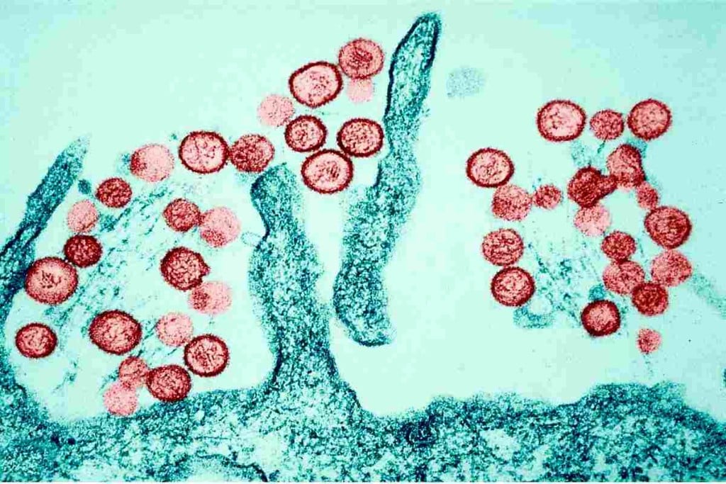El hantavirus puede provocar la misma situación que el COVID-19 Expertos lo descartan Depositphotos