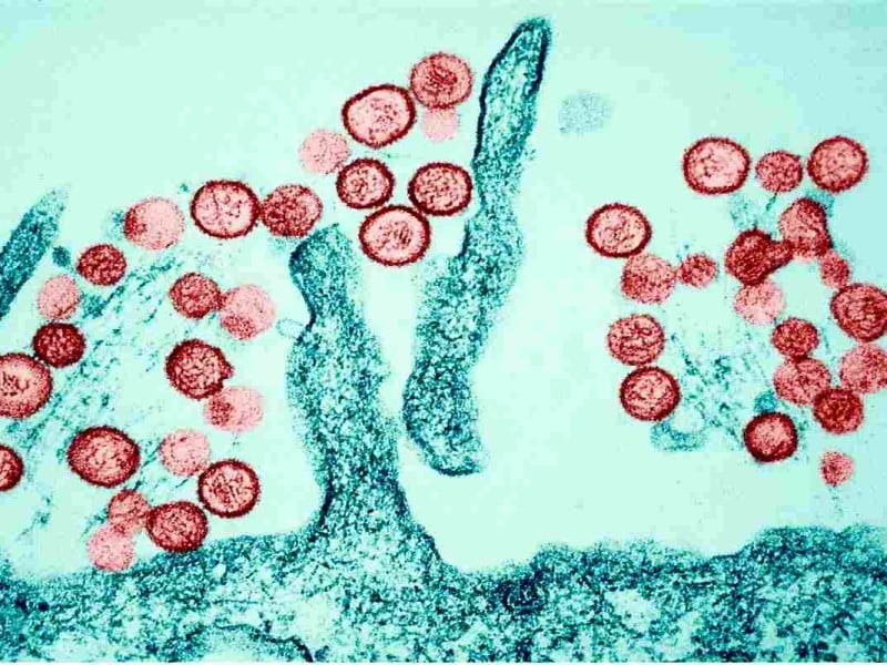 El hantavirus puede provocar la misma situación que el COVID-19 Expertos lo descartan Depositphotos